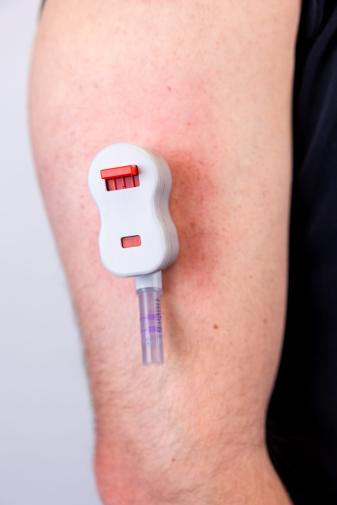 Blood Sample Collection Device For Rdata RedDrop™ Pain-Free Blood Collection Device – Stat Technologies